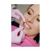 зъбни импланти Варна - 56088 постижения | Dental Club зъбни импланти Варна - 30678 постижения